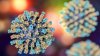 Bay Area health officials warn of potential measles exposure